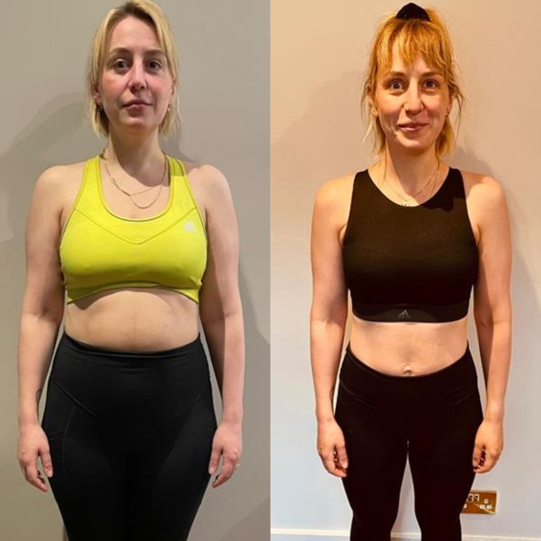 Holly, Mum of 1 — before and after